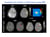 Assessing iron content in CCM lesions using QSM